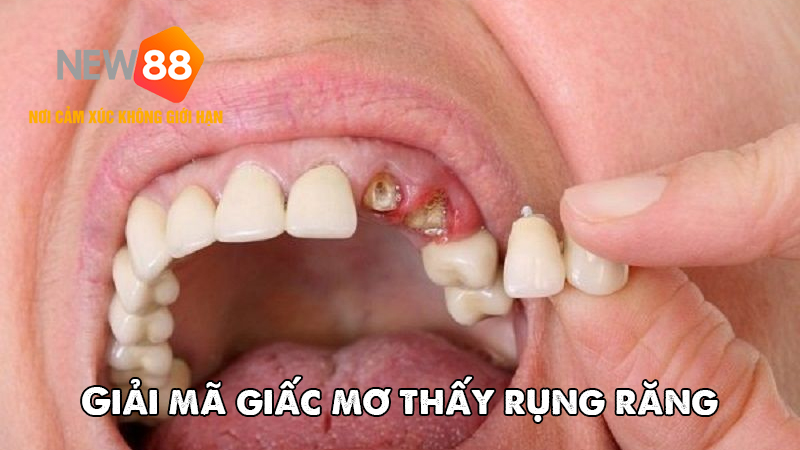 Giải Mã Giấc Mơ Nằm Mơ Thấy Rụng Răng – Điềm Gì Đang Đến Với Bạn? 6 Góc nhìn khoa học qua giấc mơ thấy rụng răng